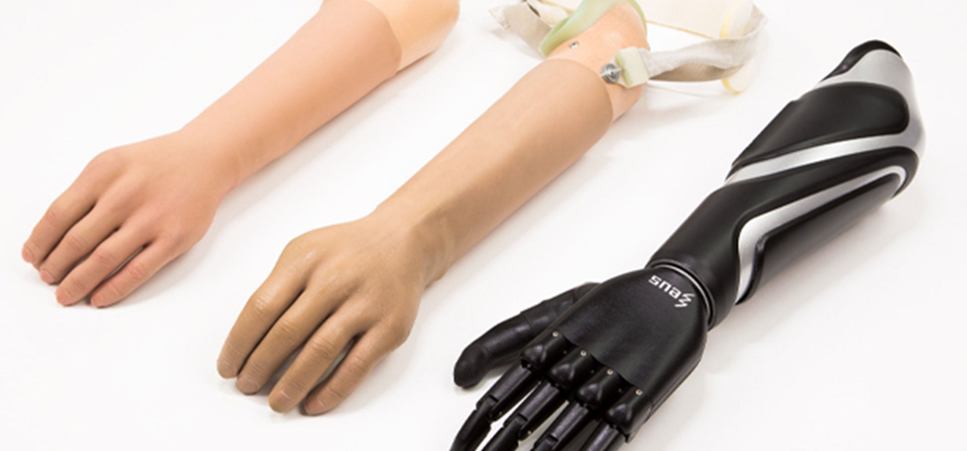 Cost-Efficient Upper-Limb Prosthetic Care with the Zeus Hand Ecosystem 