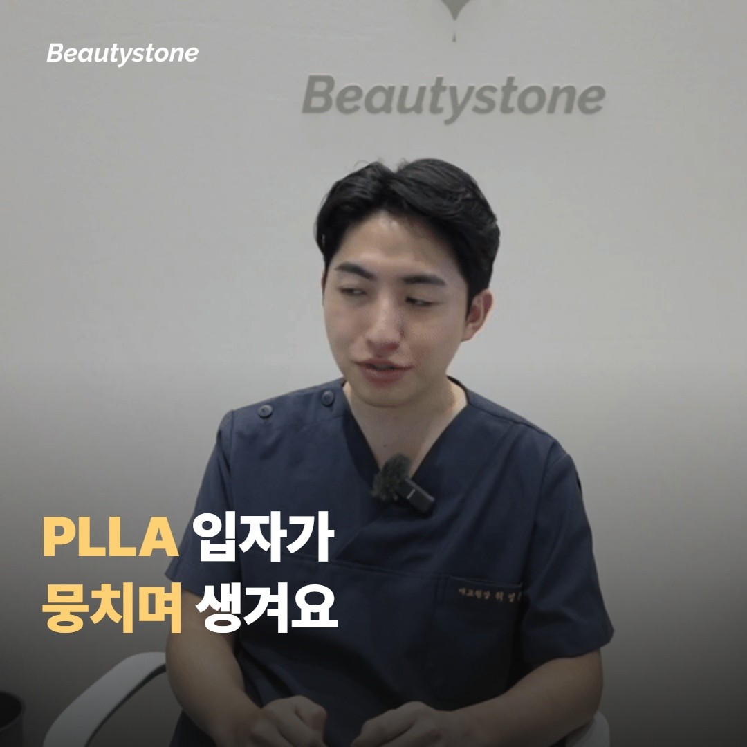 스컬트라 결절은 PLLA 입자가 뭉치며 생기는 응집이에요