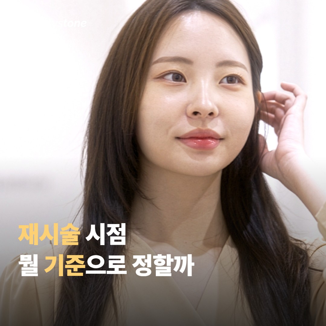 재시술 시점은 뭘 기준으로 정하면 좋을까요