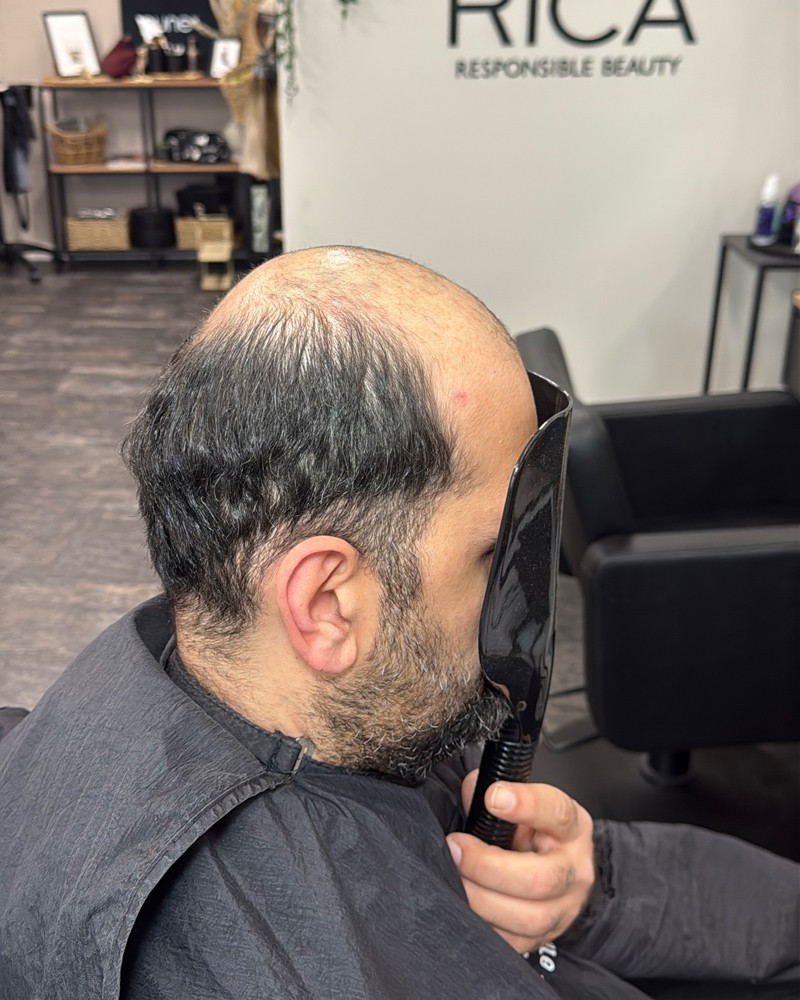 Cortese Haarsysteme - Vorher-Ansicht 6