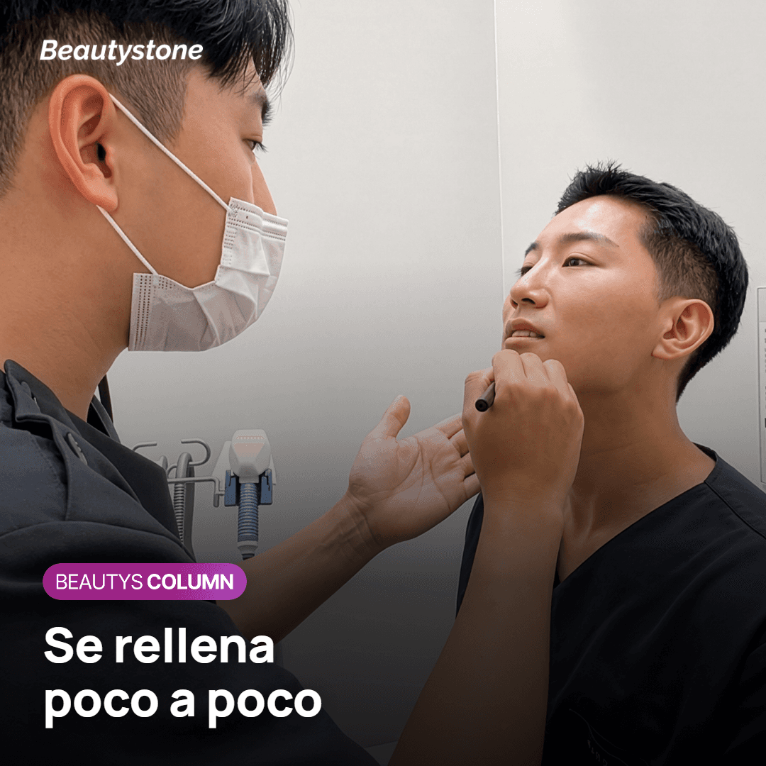 Fotos de la mejilla antes del tratamiento y 3 meses después de la última sesión, tomadas en iguales condiciones
