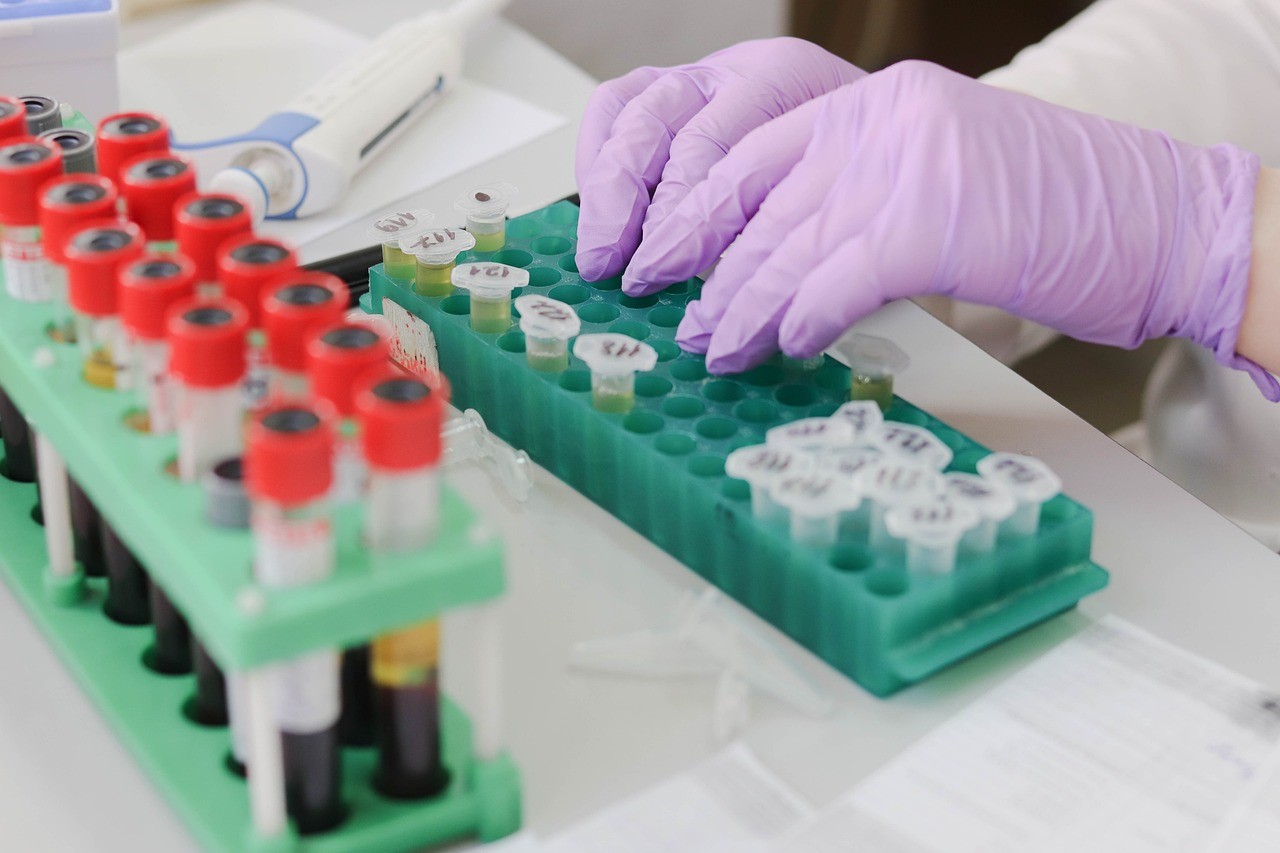 A veterinarian organizing blood samples from pet patients