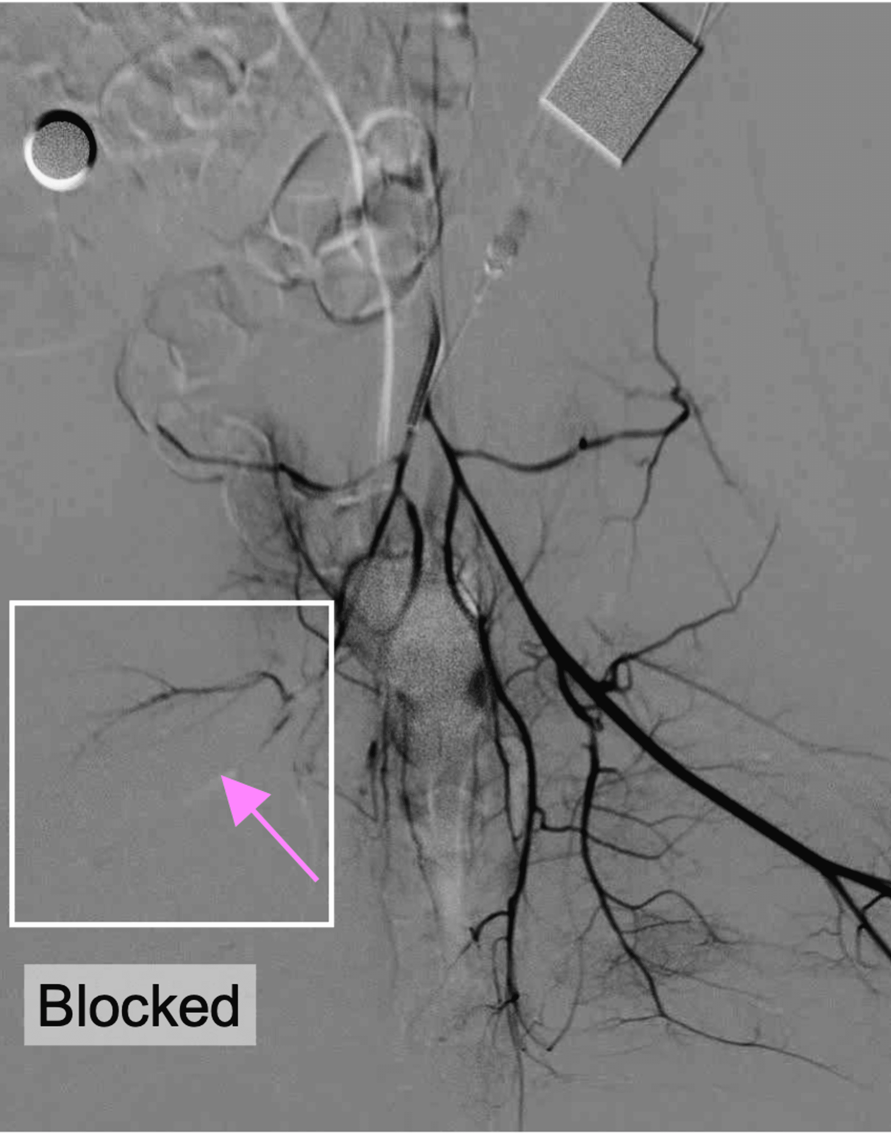 Coach explaining stuff to an athlete