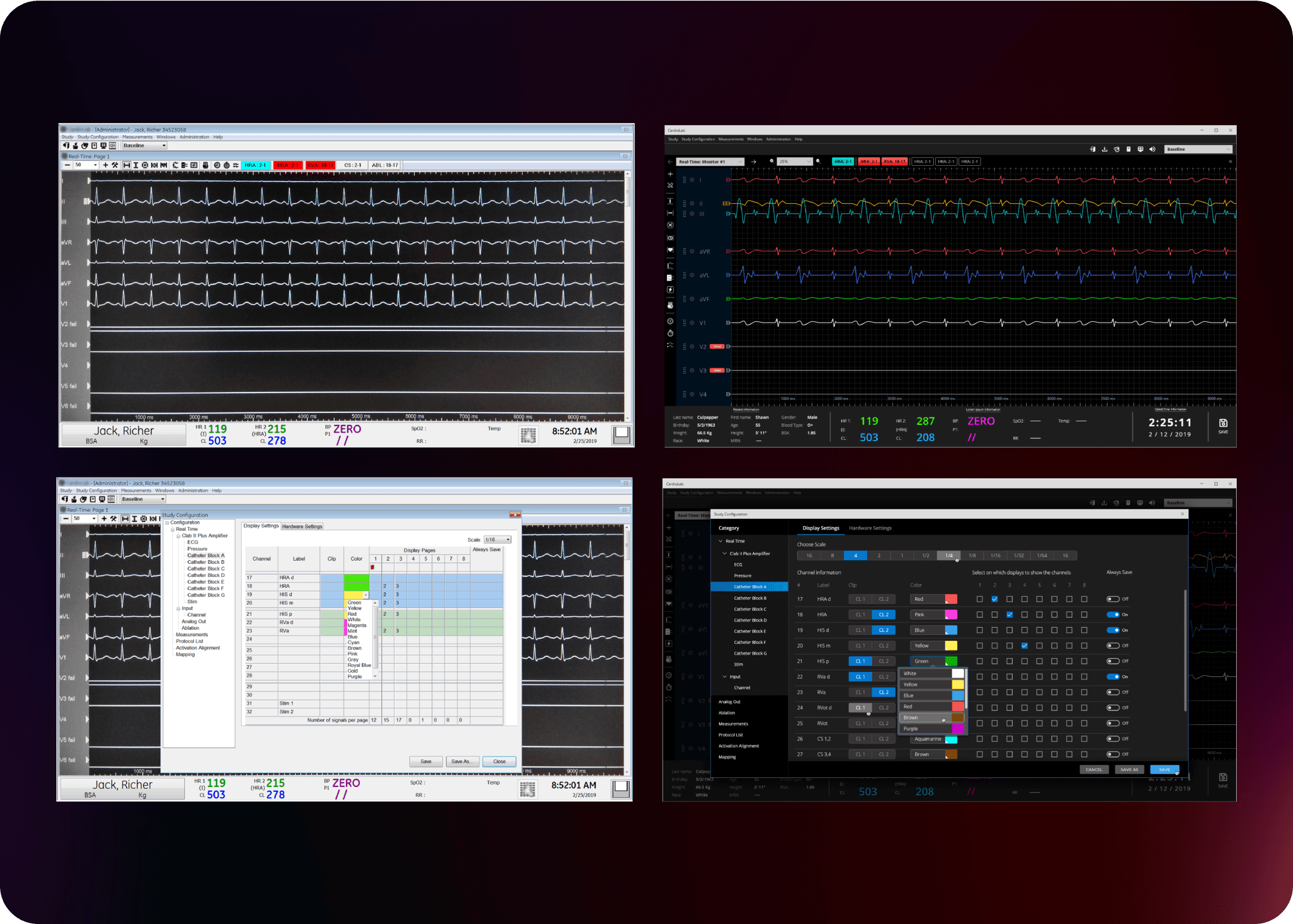 GE - Cardio Lab - UI design Comparison