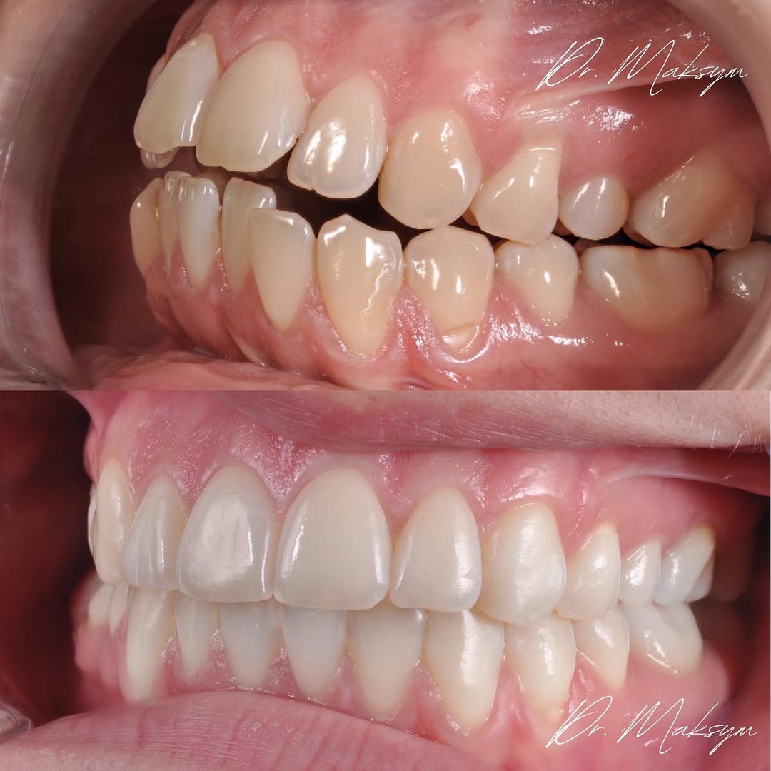 a dentist chair in a room with a painting on the wall