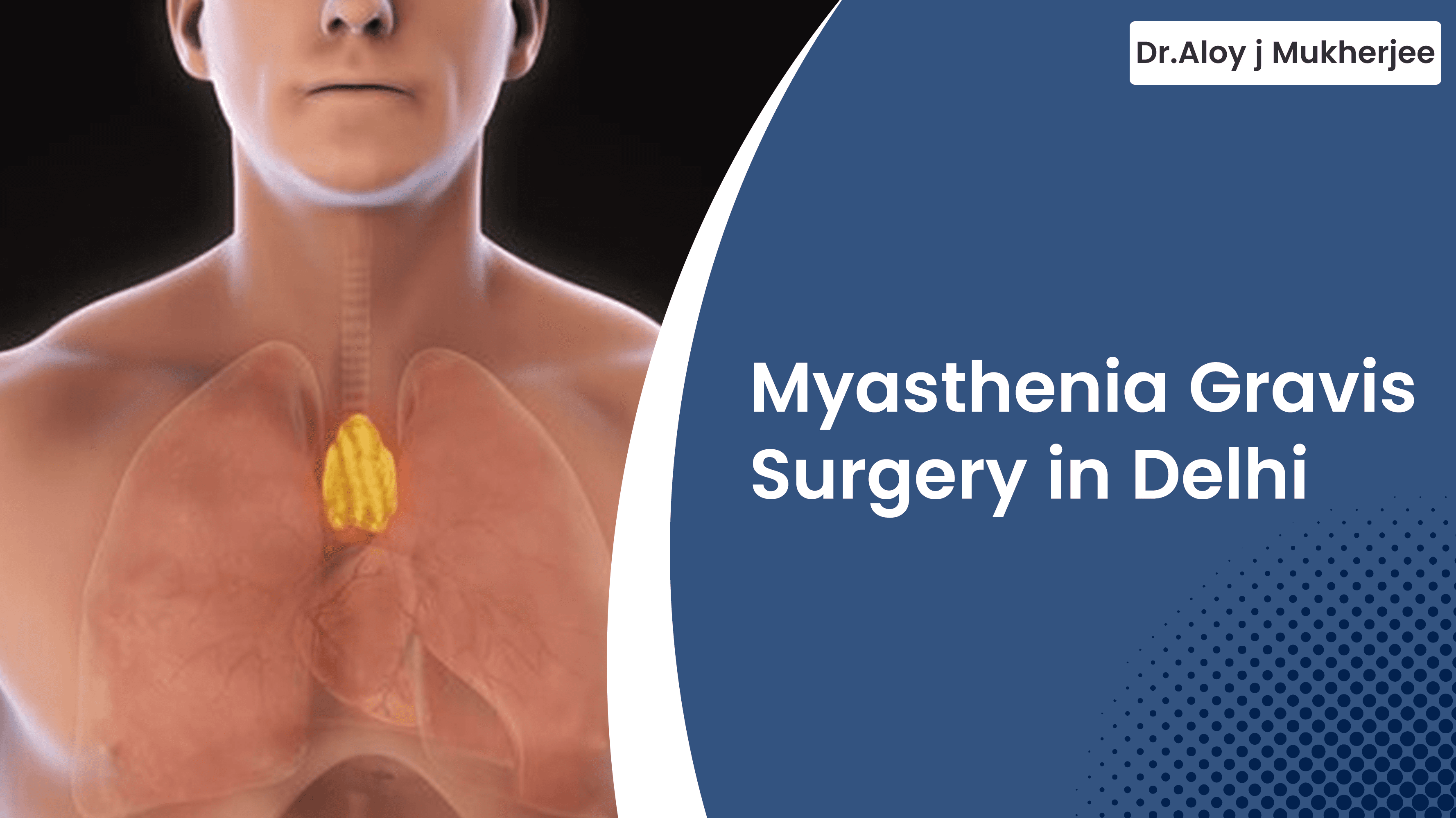 Myasthenia Gravis Surgery in Delhi | Dr Aloy Mukherjee