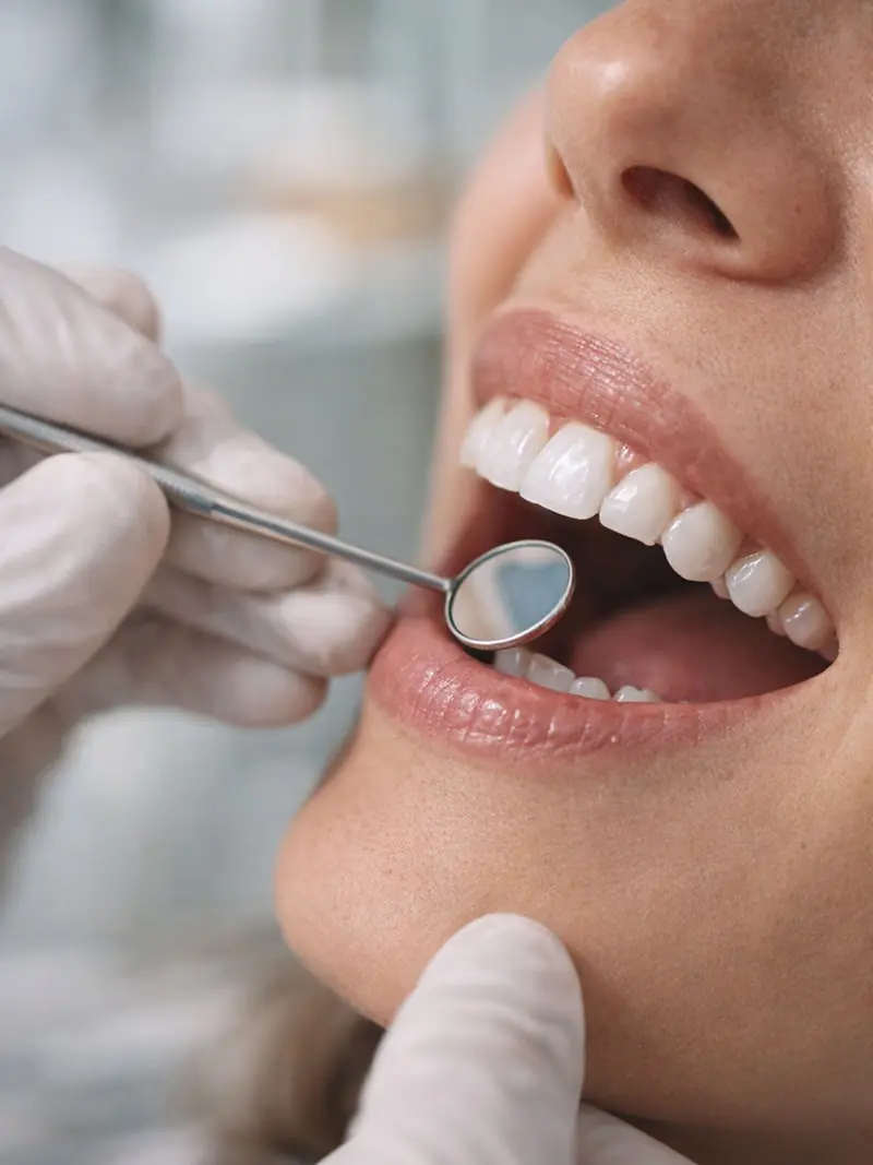 closeup of a dental inspection