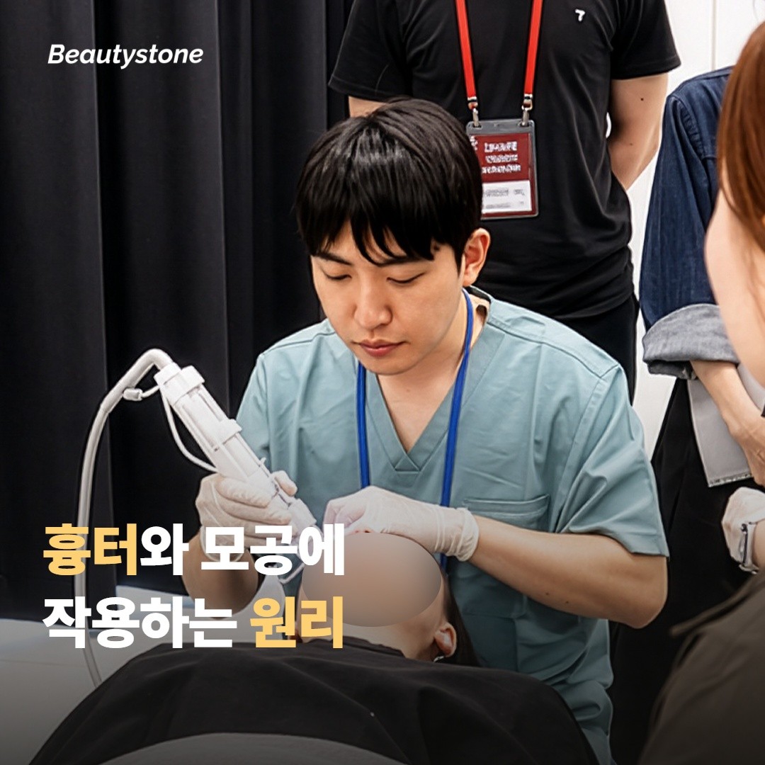 포텐자가 흉터와 모공에 작용하는 원리