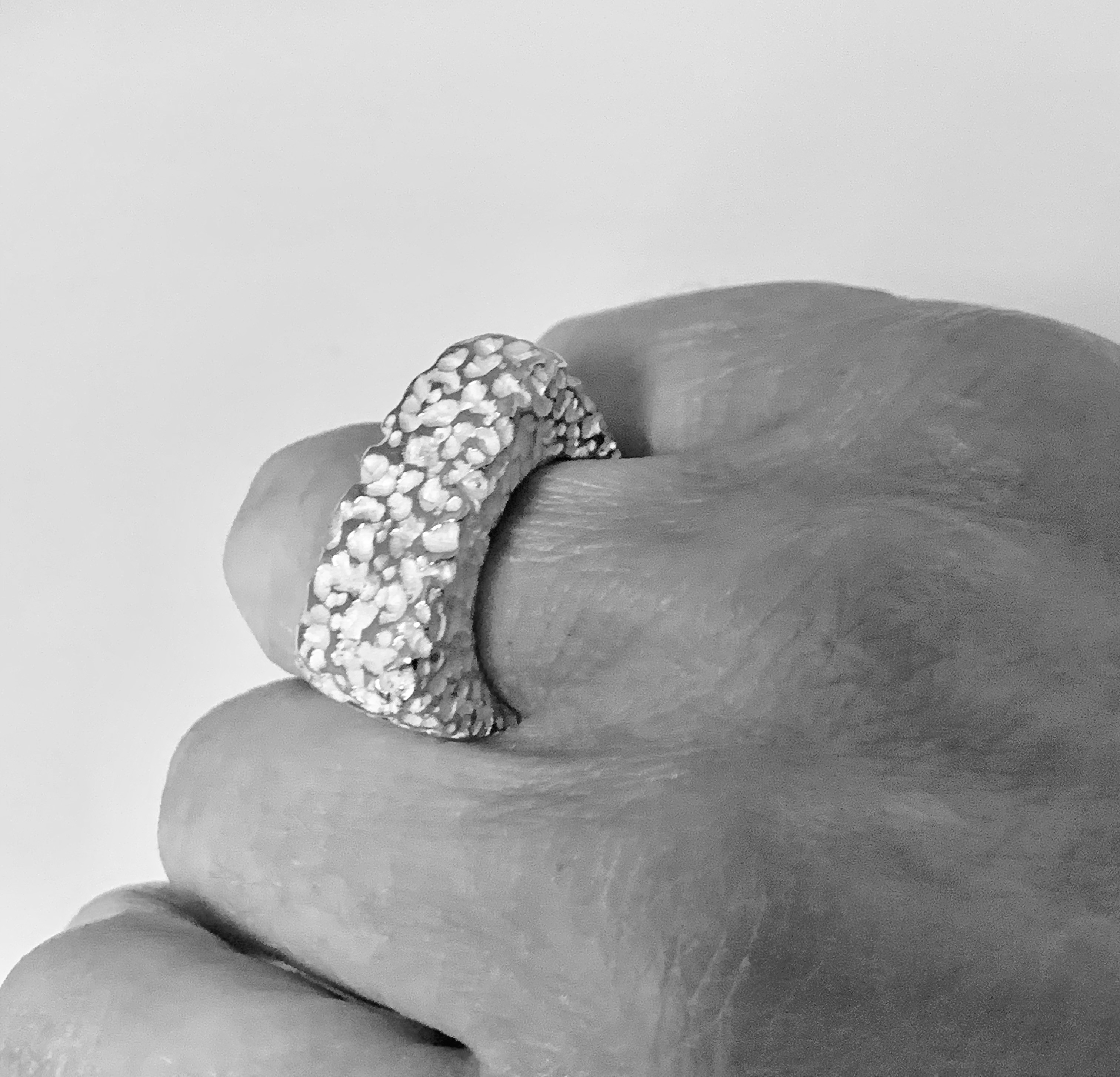 Déclinaison calcaire