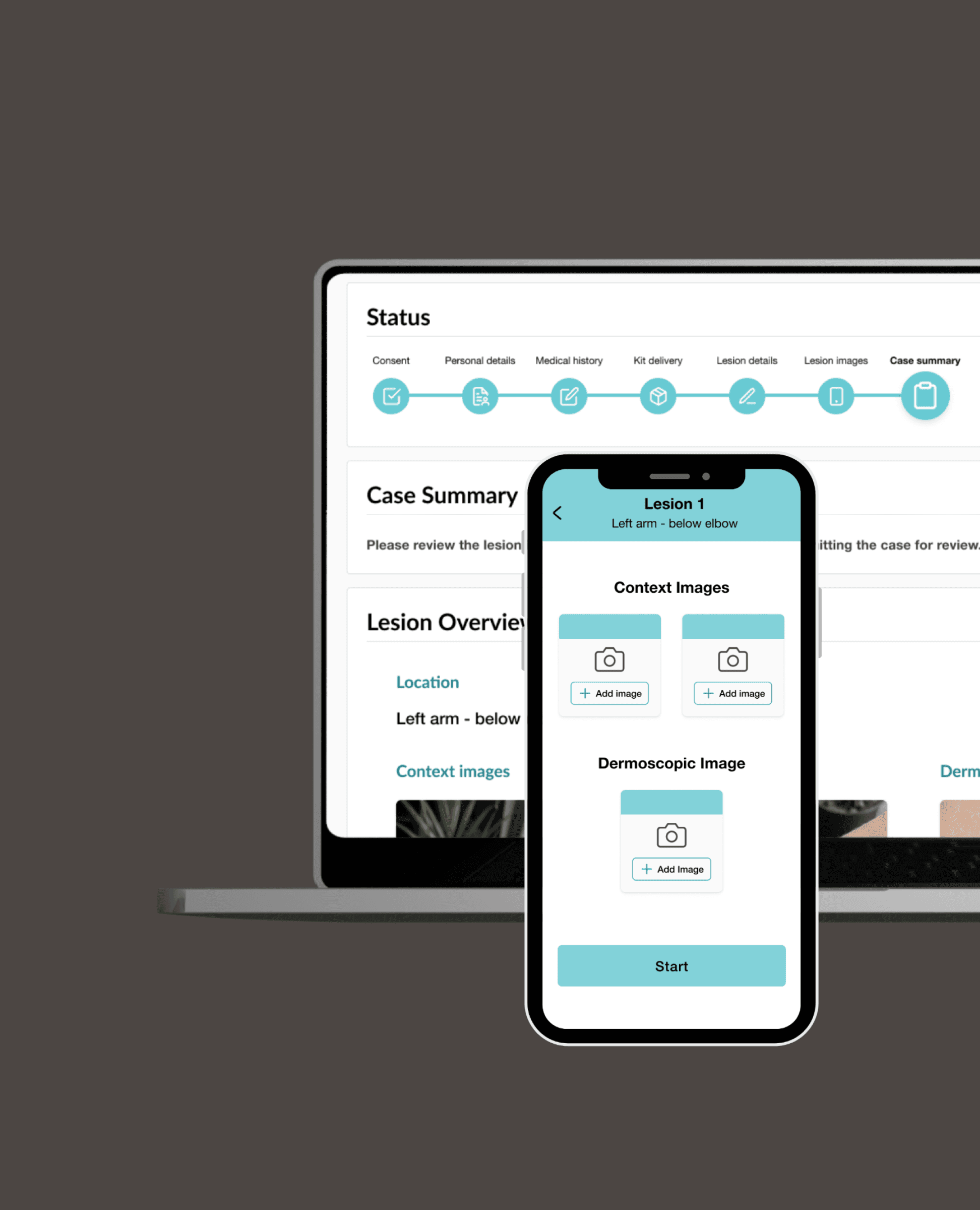 Case study hero image