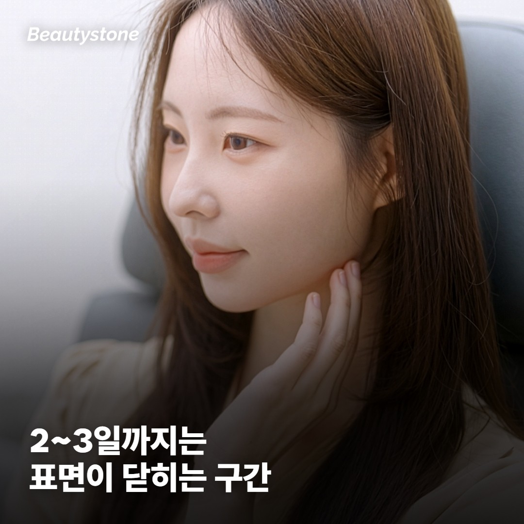 직후부터 2~3일까지는 표면이 닫히는 구간이에요