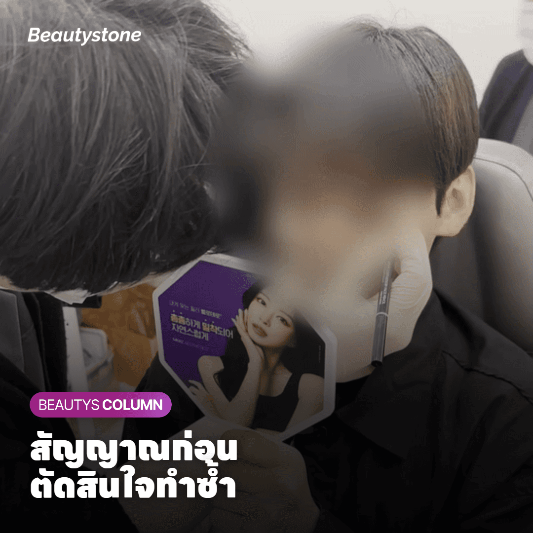 สัญญาณที่ใช้จริงเวลาตัดสินใจว่าจะทำซ้ำเมื่อไหร่