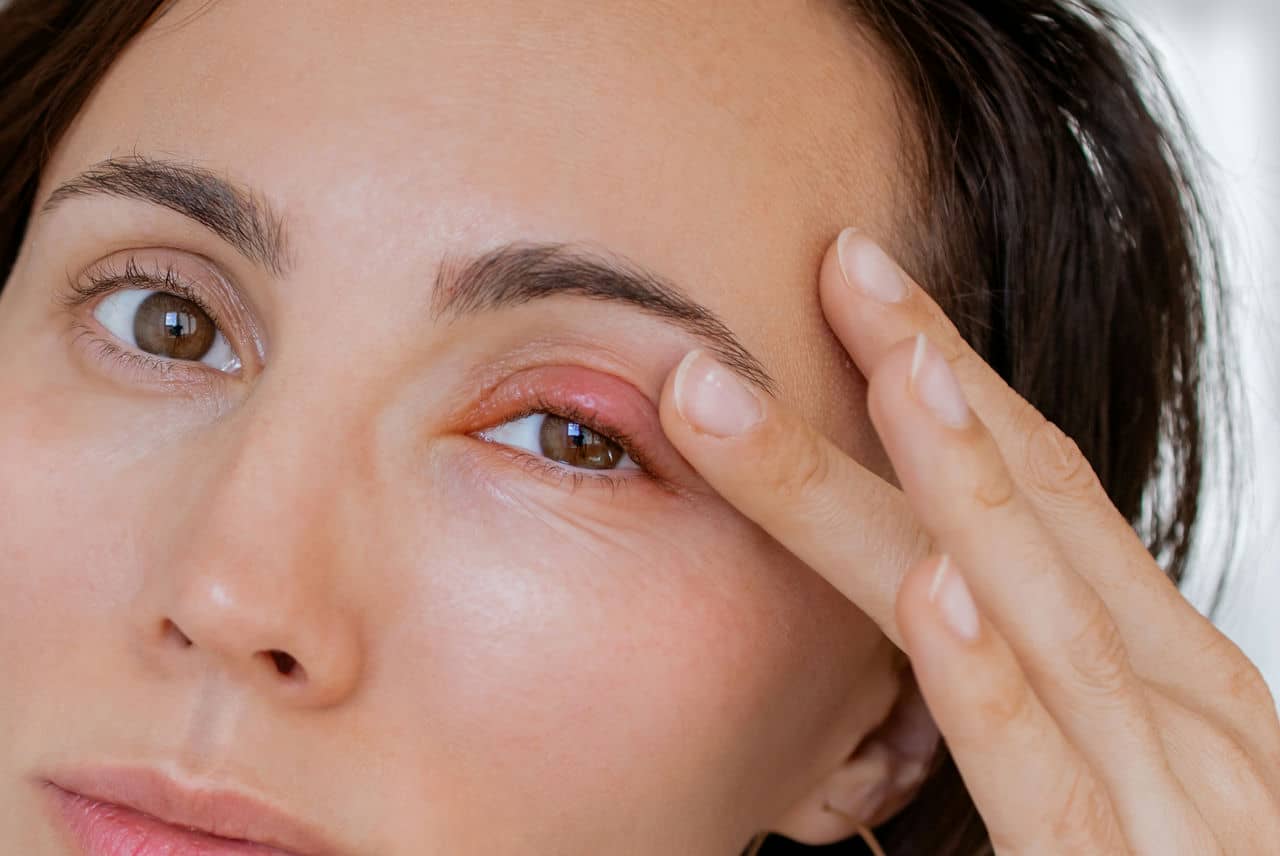 Swelled up eye - Semaglutide Eye Side Effects