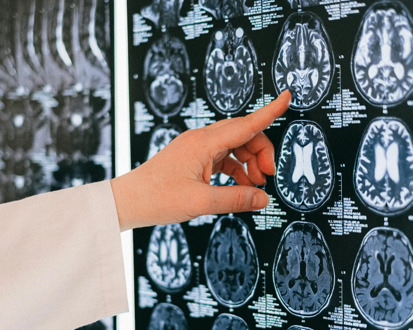 Imagen de estudios del cerebro referente a la carga cognitiva en el ecommerce