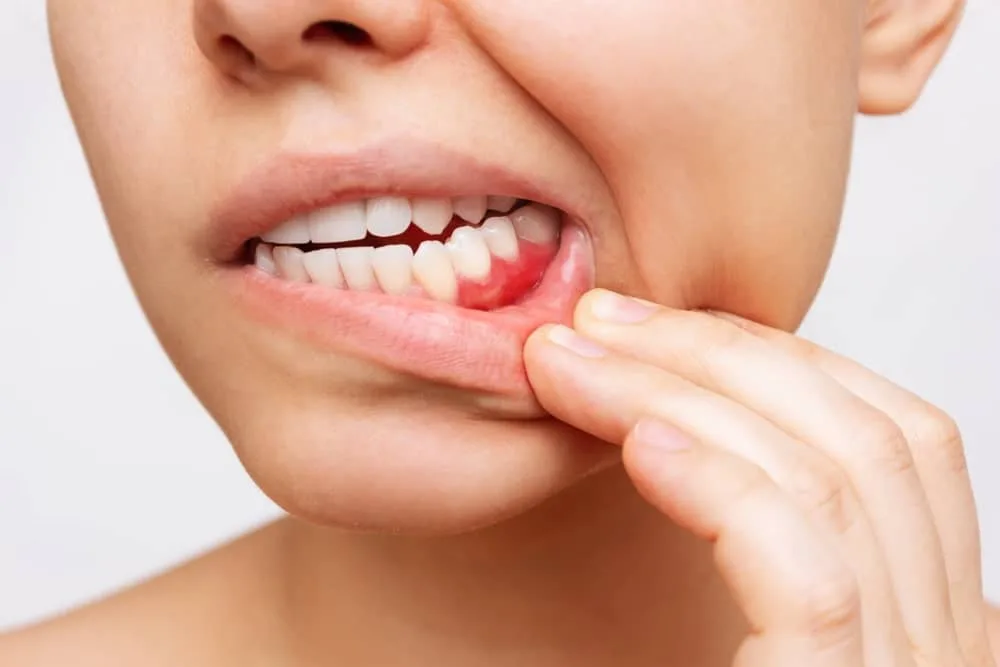 dental implant problems