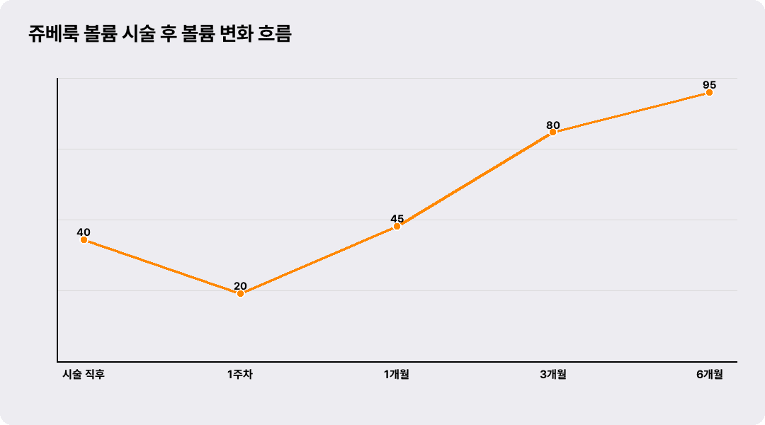 쥬베룩 볼륨 시술 후 볼륨 변화 흐름