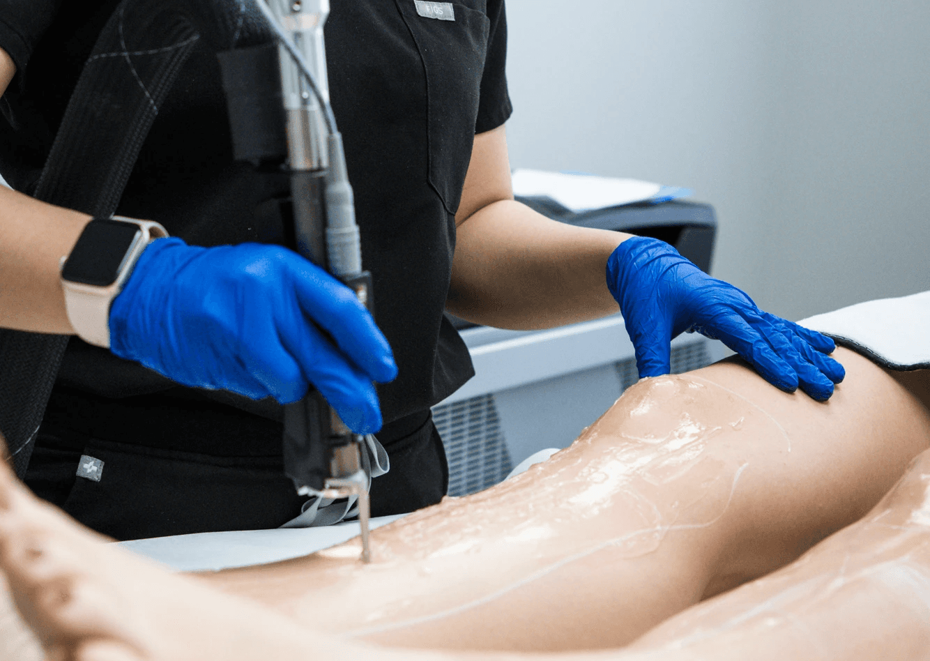 Beautician and a patient getting their legs laser hair removal