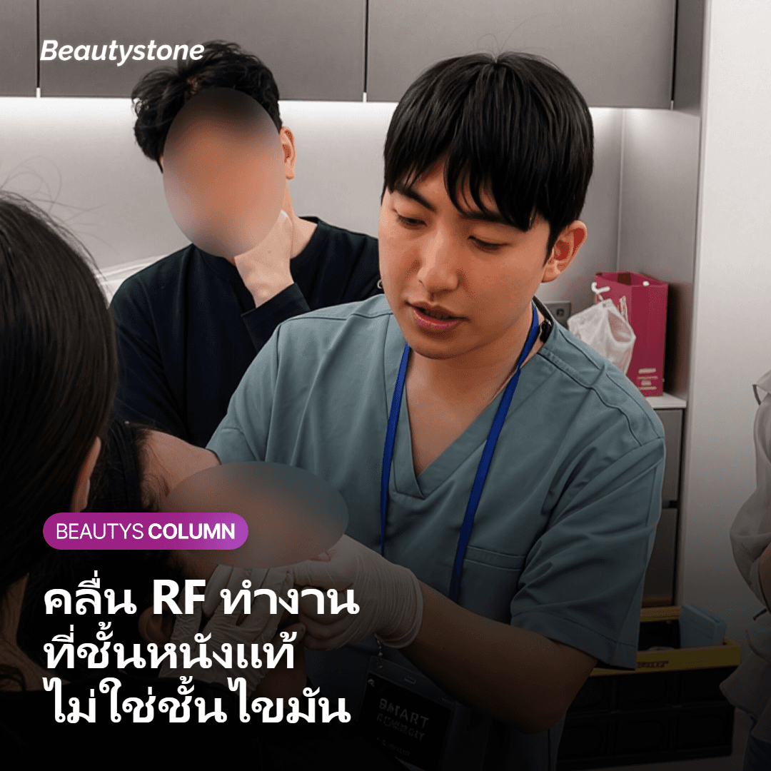 ภาพตัดขวางแสดงคลื่น RF ของ Thermage ที่ทำงานในชั้นหนังแท้ ไม่ถึงชั้นไขมัน