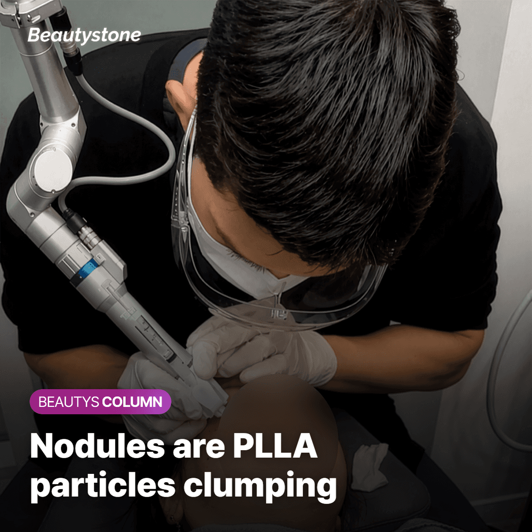 Sculptra nodules are small clumps formed when PLLA* particles gather together