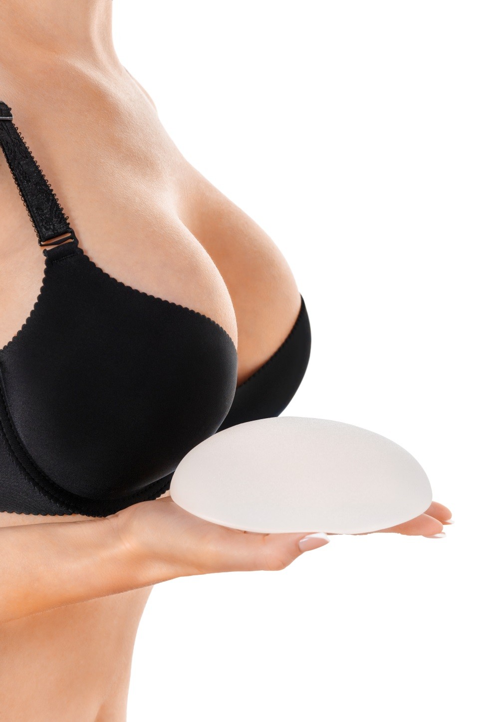 Breast Augmentation (Implants)