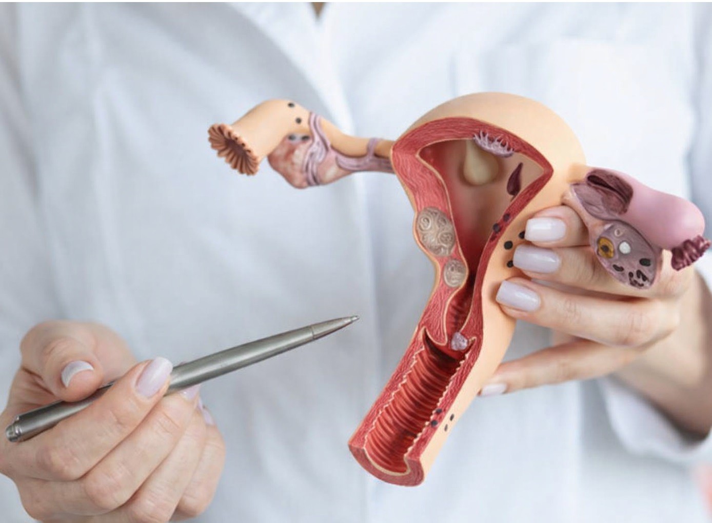 Miss Zeina Haoula – Consultant Gynaecologist in UK