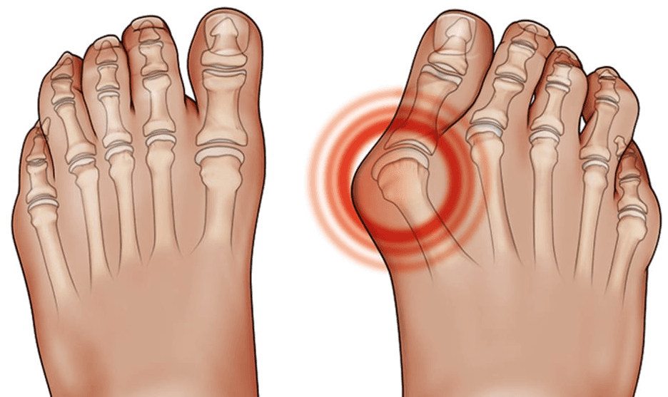 alterazione strutturale potenza