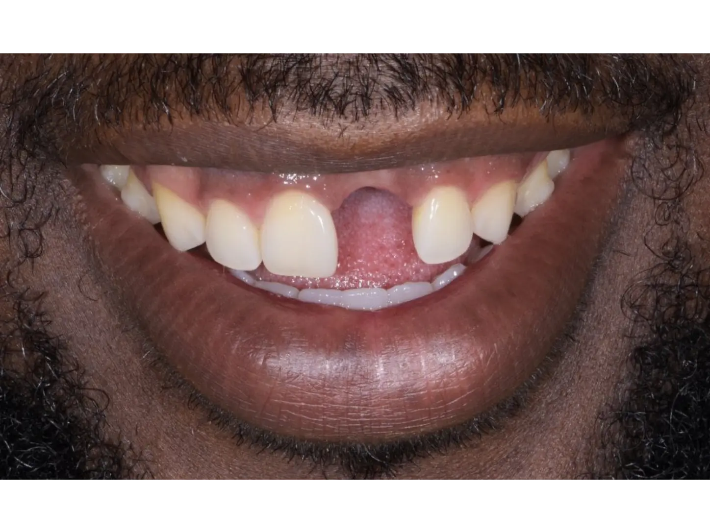 dental exam with mirror and tool