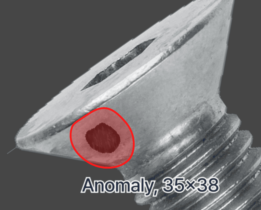 anomaly segmentation
