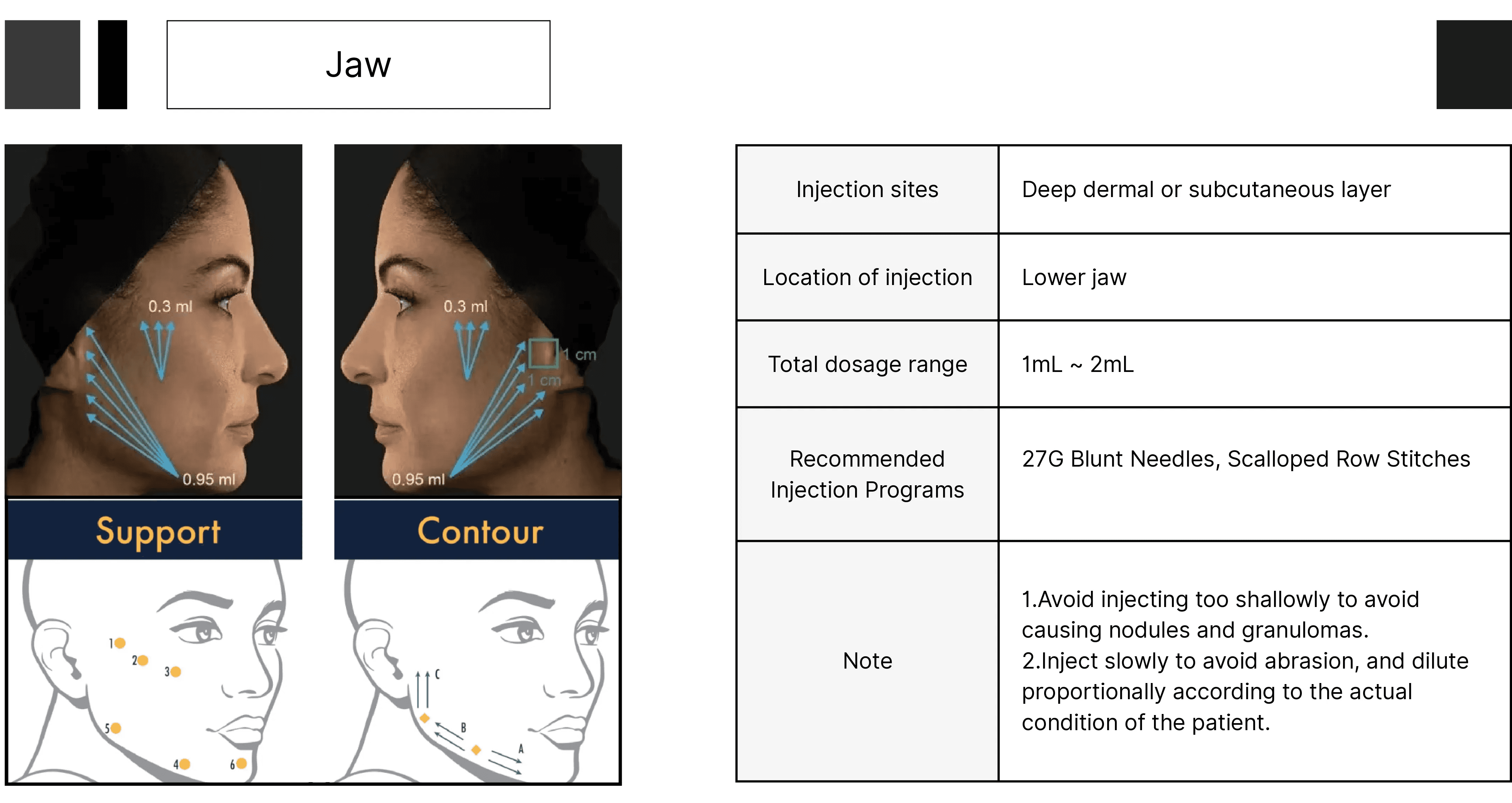 injection area-jaw effect