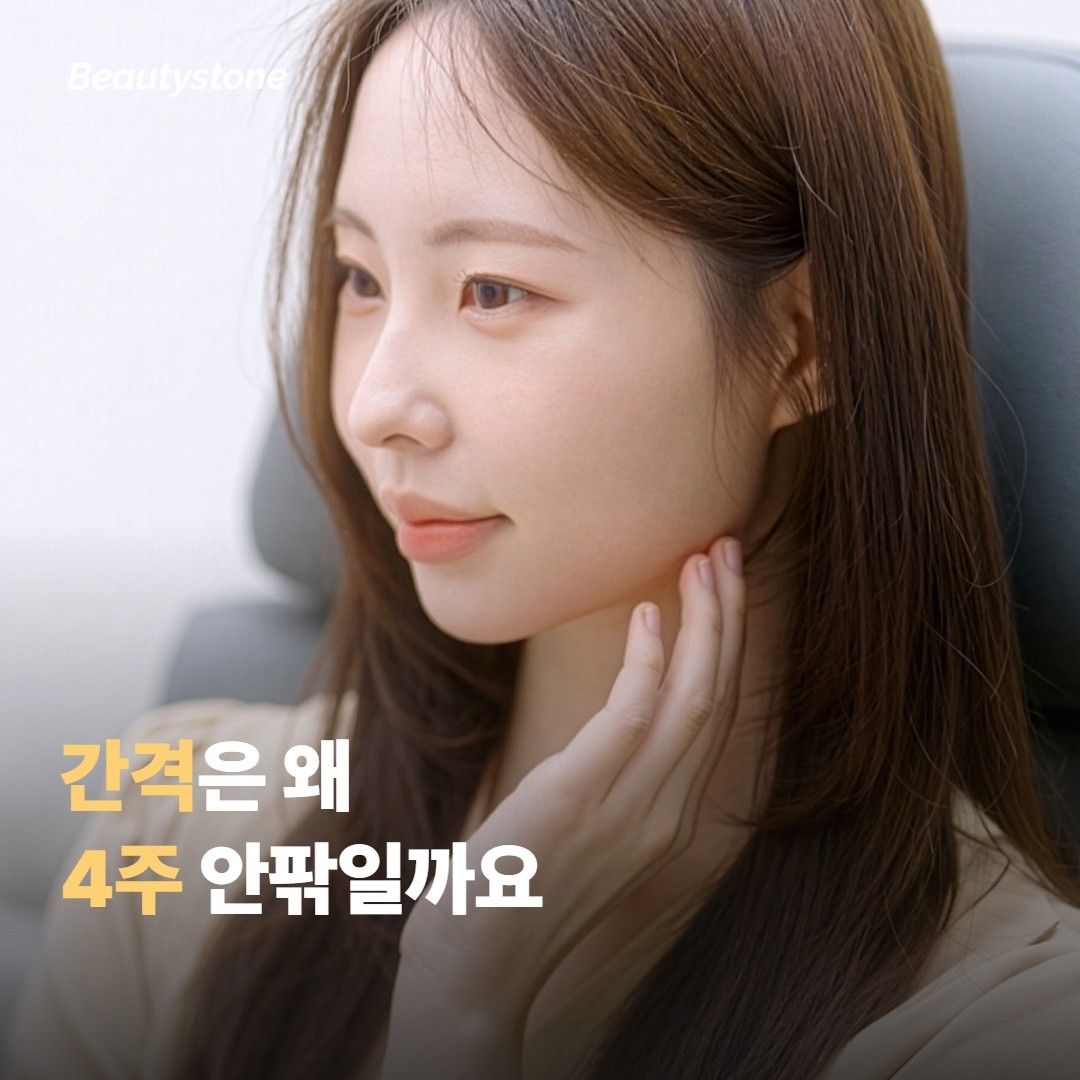 간격은 왜 4주 안팎으로 두나요