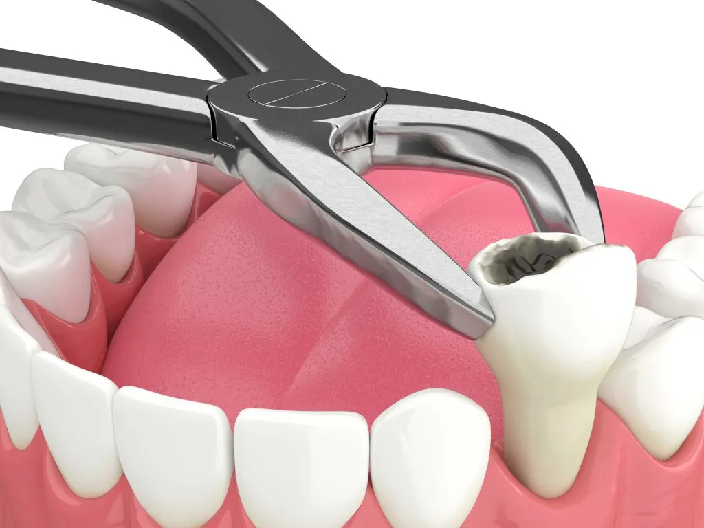 A smiling dentist in a white coat holding a clear dental aligner