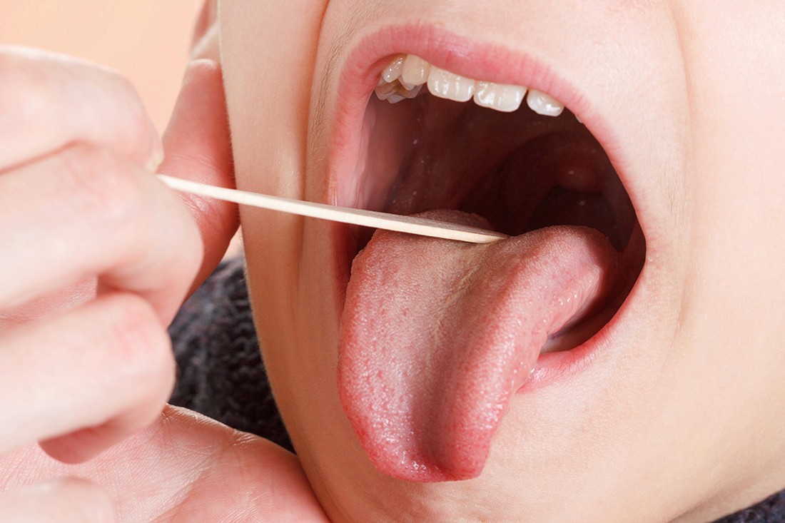 Oral Cancer screening for a child at Shirlington Pediatric Dentistry, Arlington