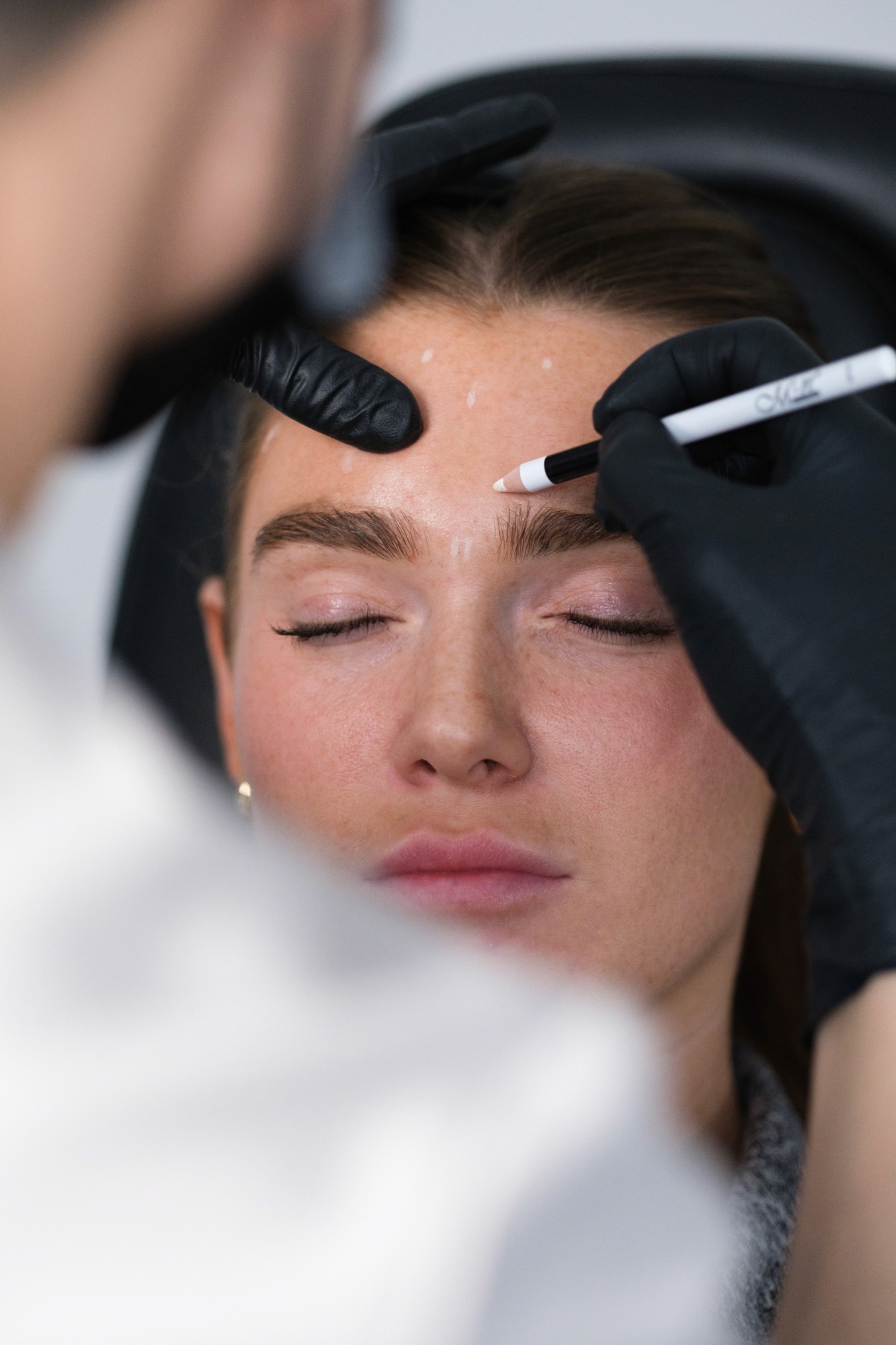 Dr Alex Nguyen marquant le visage d'une patiente en préparation des injections