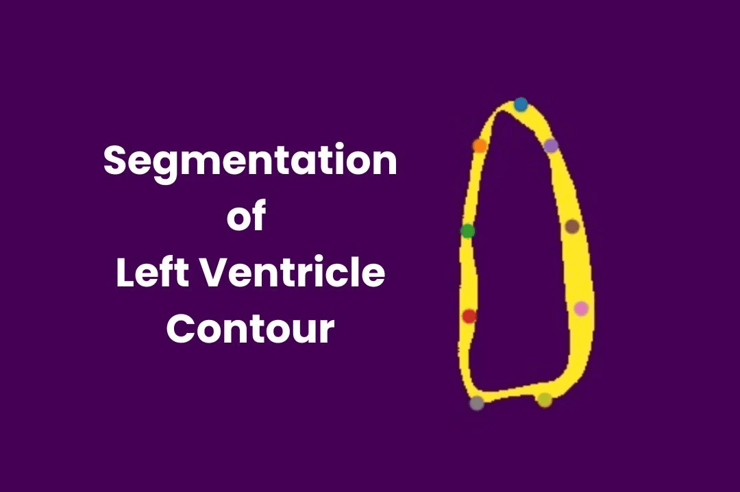 SegmSegmentation of Left Ventricle Contour using U-NET