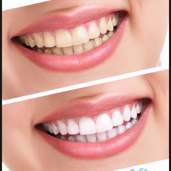 Radiant White Smiles of Austin Screenshot