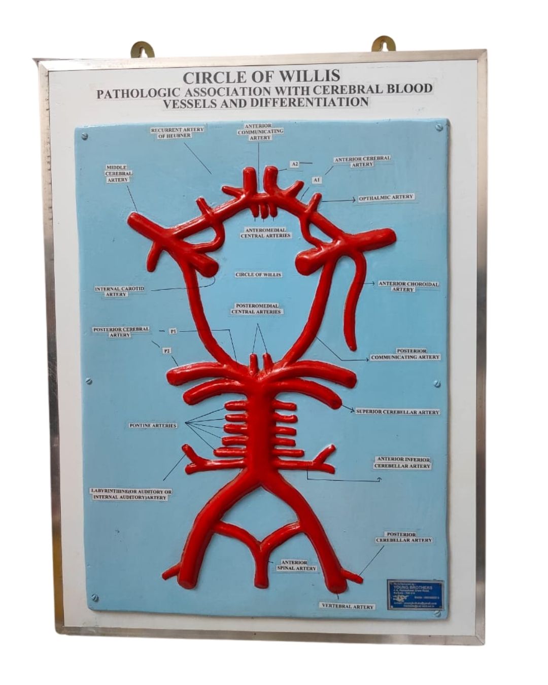 Circle of Willis