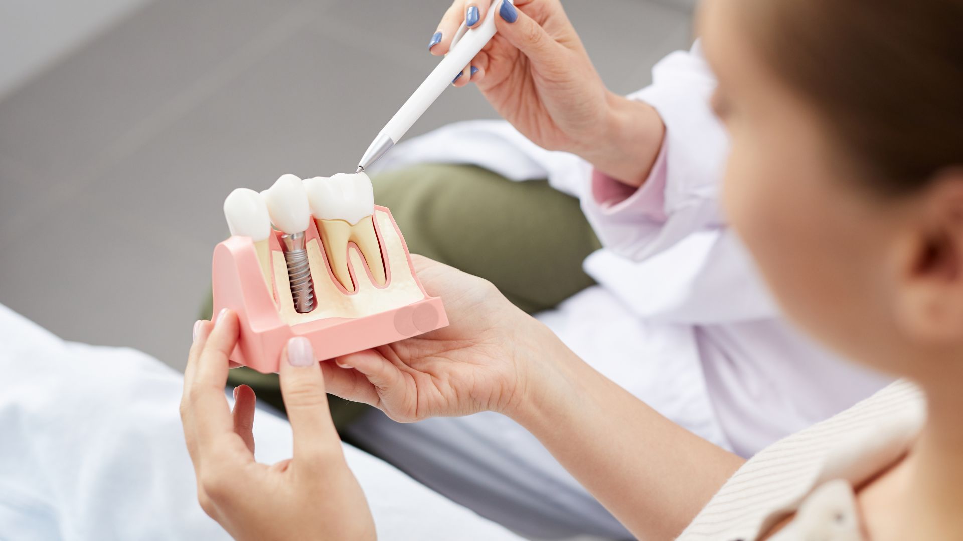 loose dental implant