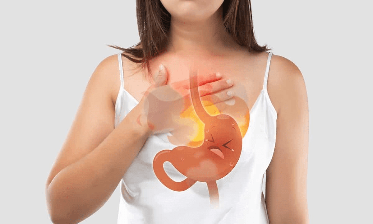Managing Acid Reflux while on Semaglutide