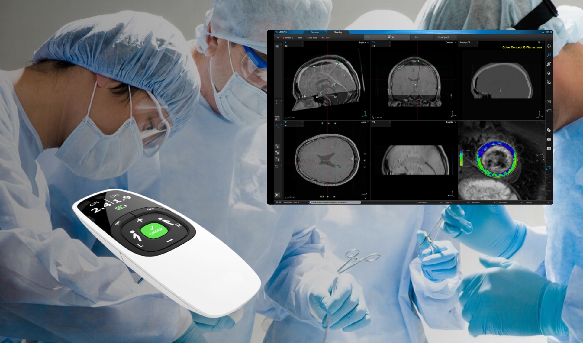 Photo of user interface for MRI software suite for Sapiens - Medtronic