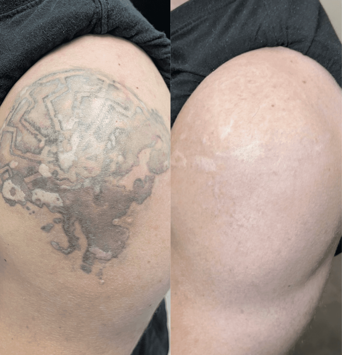 Haarausfall Männer Schweiz