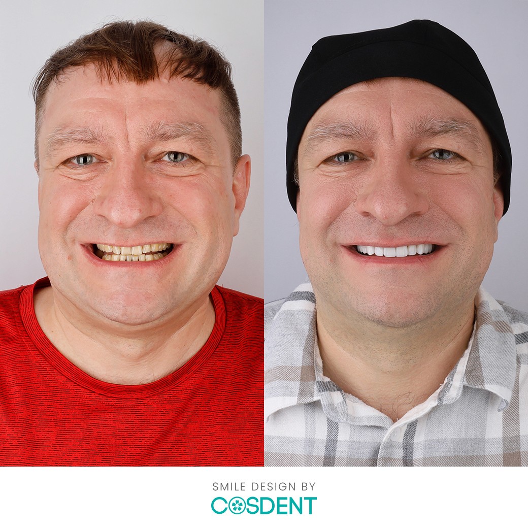 ผลงานการเปลี่ยนแปลงรอยยิ้มที่ COSDENT