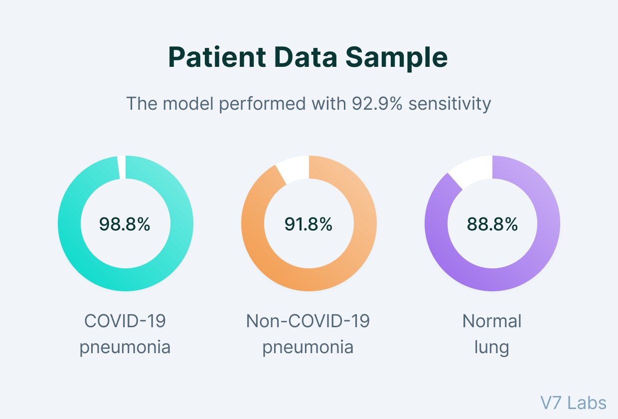 Patient sample in covid-19 AI model performance