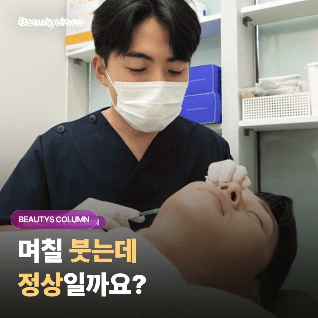 지방분해주사 맞고 며칠 붓는다는데, 정상일까요?