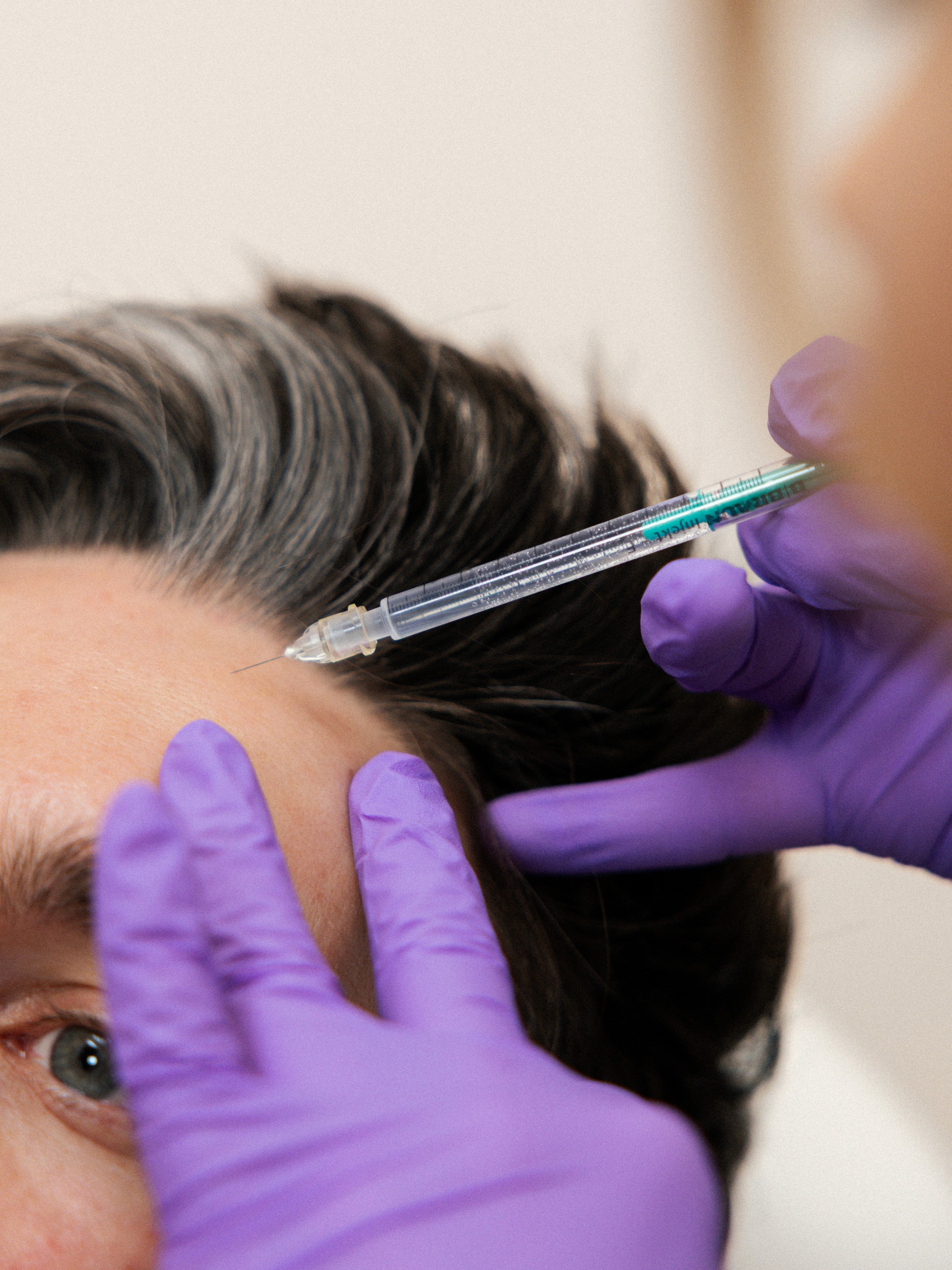 Dr. Louise Cuveele die een patiënt injecteert met botulinumtoxine.