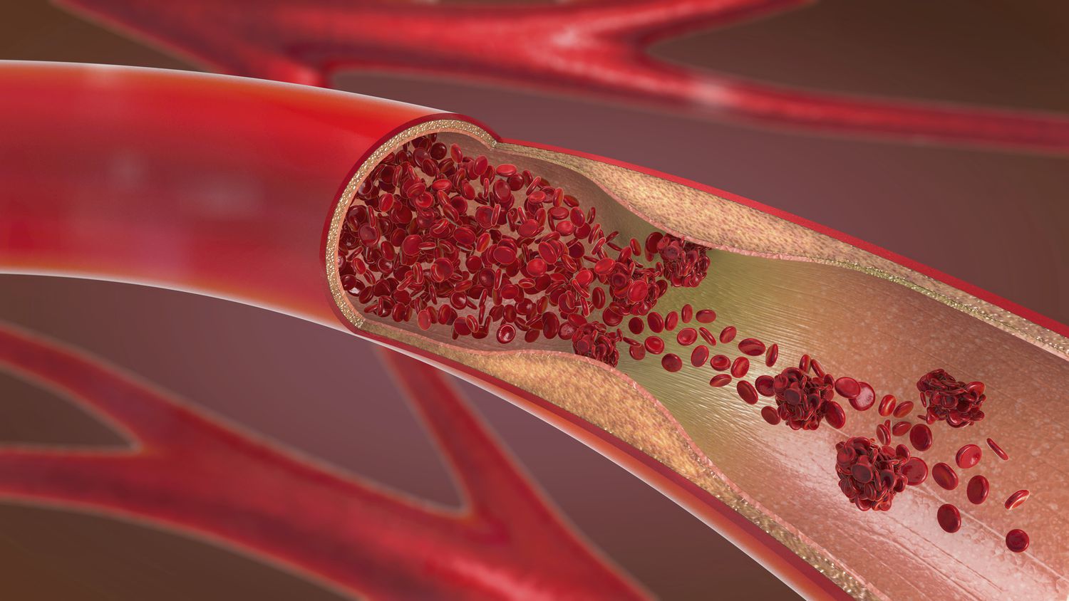 Expert surgical and endovascular care for all circulatory and venous conditions.