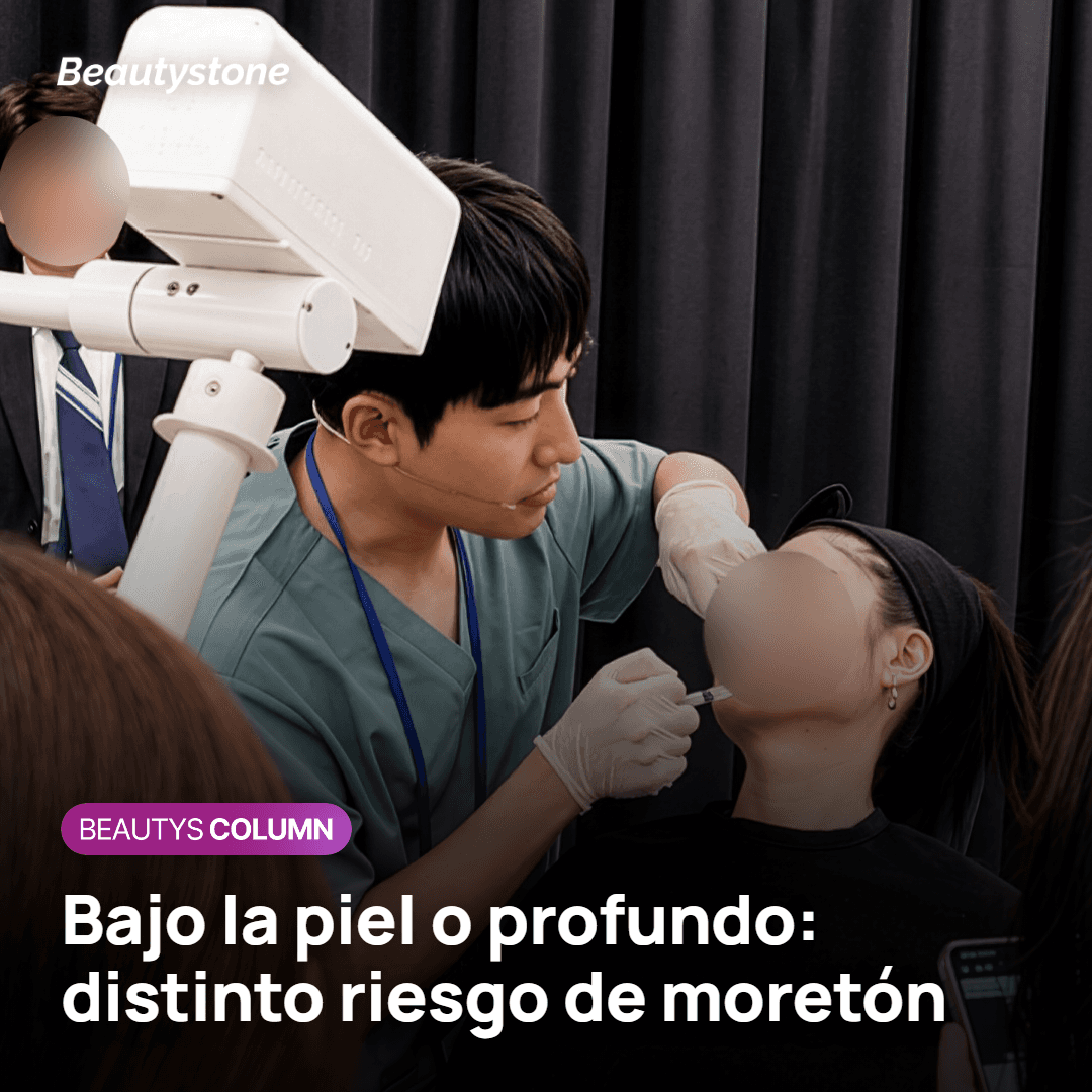 Capa de inyección y riesgo de moretón con Ellansé