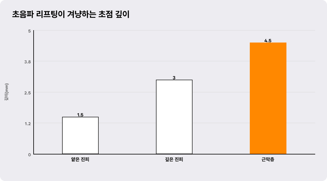 초음파 리프팅이 겨냥하는 초점 깊이