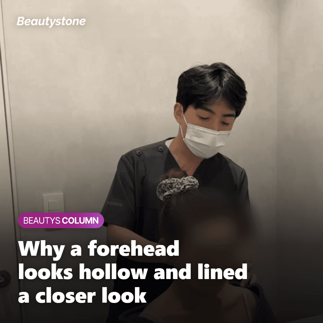 Illustration showing why a forehead looks hollow and gains fine lines