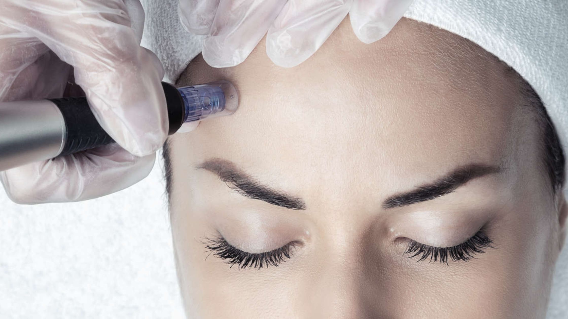 Top 5 Microneedling Clinics in Frisco