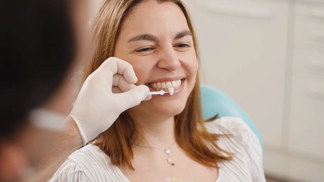 Colocação de Facetas Dentárias